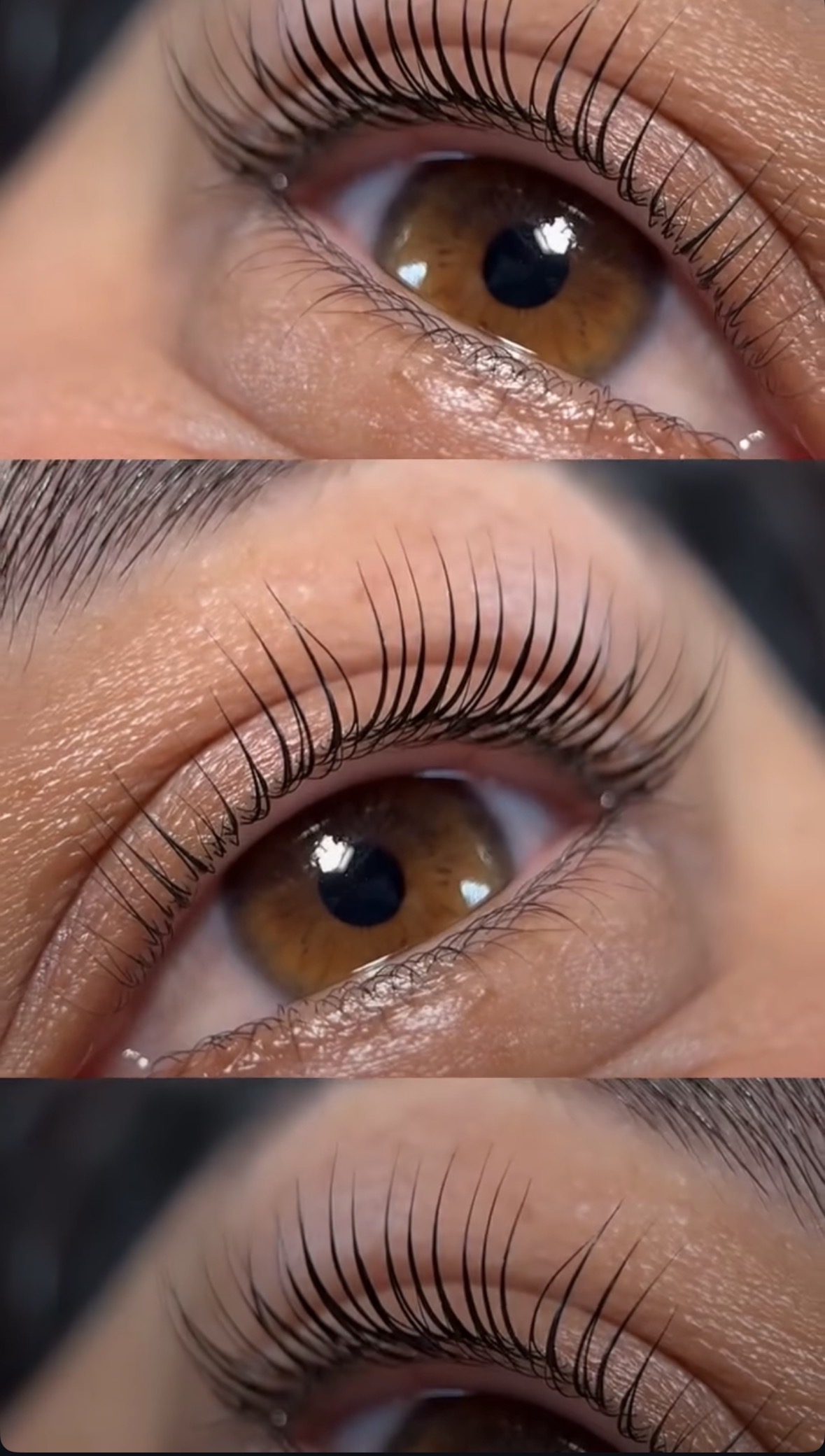 Eva Güzellik Merkezi hydrafacial cilt bakımı sonucu